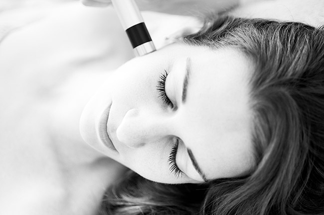 Mikrodermabrasion